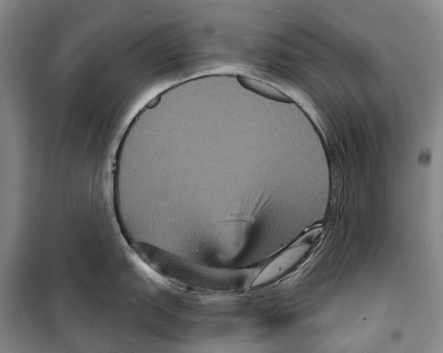 X0000099381151200806051115