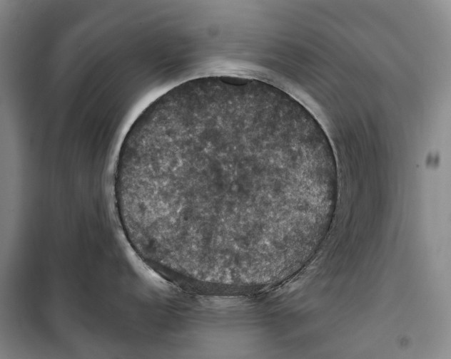 X0000099381152200806051115