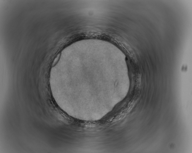 X0000099381153200806051114