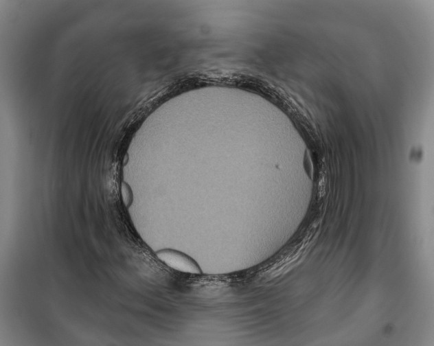 X0000099381156200806051114