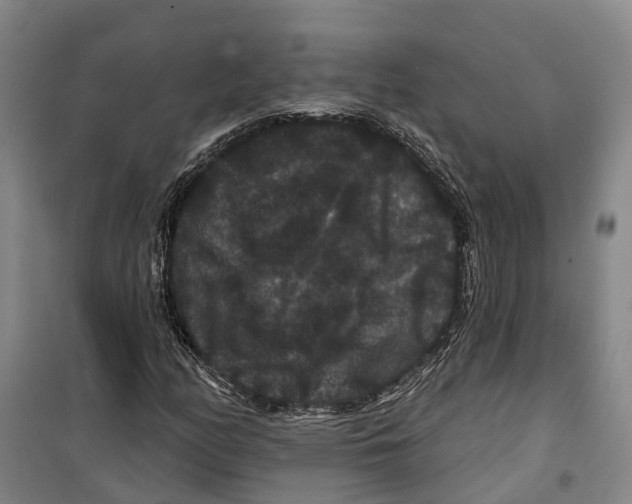 X0000099381158200806051114