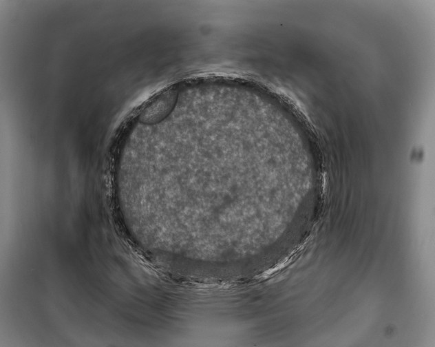 X0000099381159200806051114