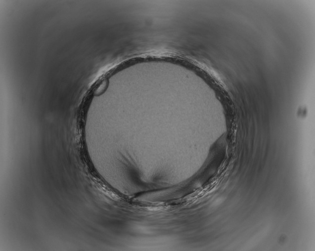 X0000099381160200806051114