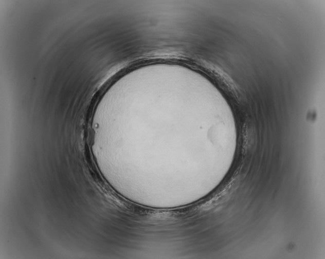 X0000099381162200806051114