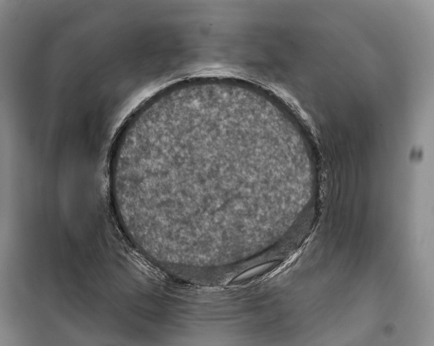 X0000099381167200806051114