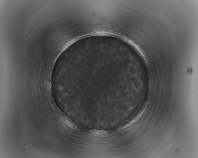 X0000099381170200806051114