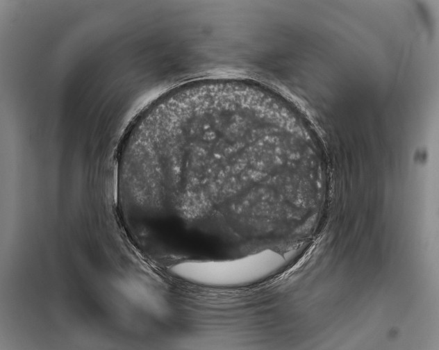 X0000099381171200806051114