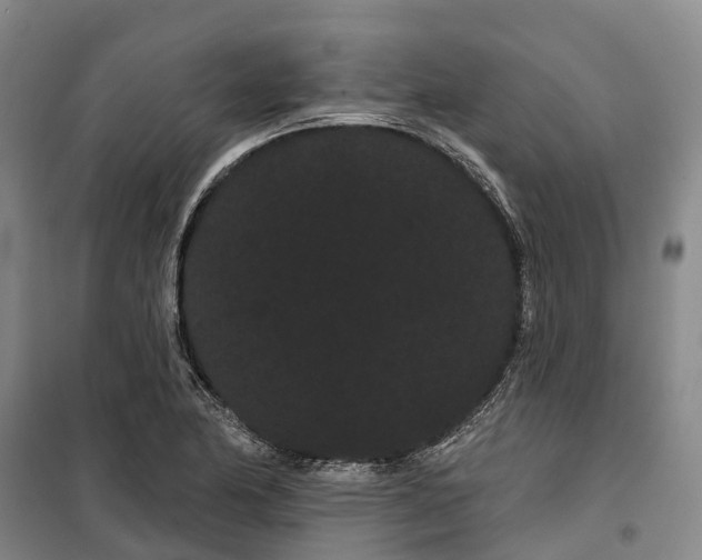 X0000099381174200806051114