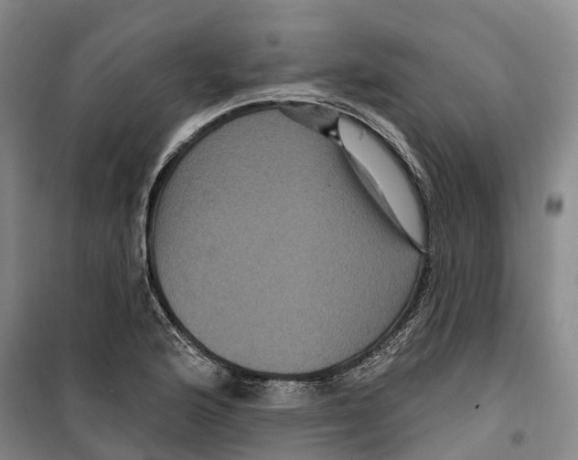 X0000099381176200806051114