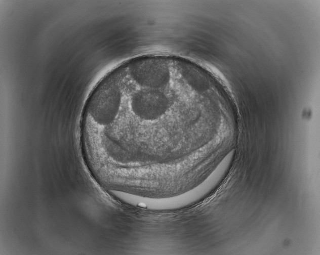 X0000099381183200806051114