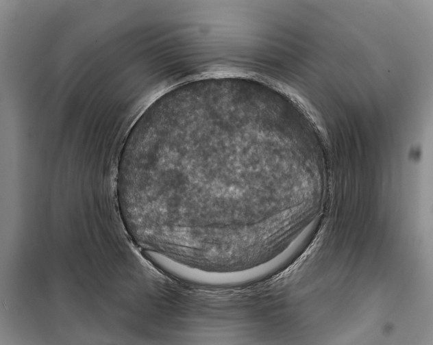 X0000099381185200806051114