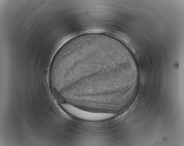 X0000099381186200806051114