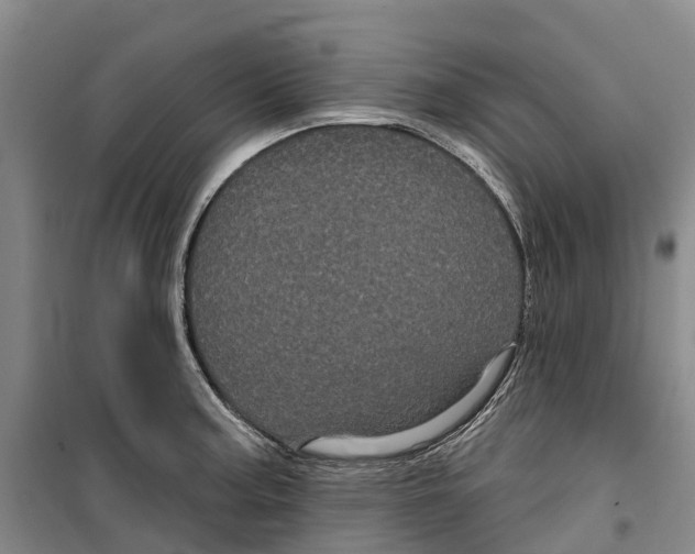 X0000099381187200806051114