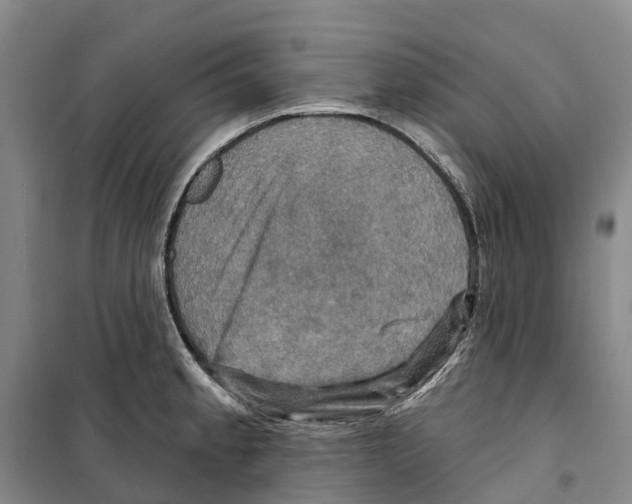 X0000099381189200806051114