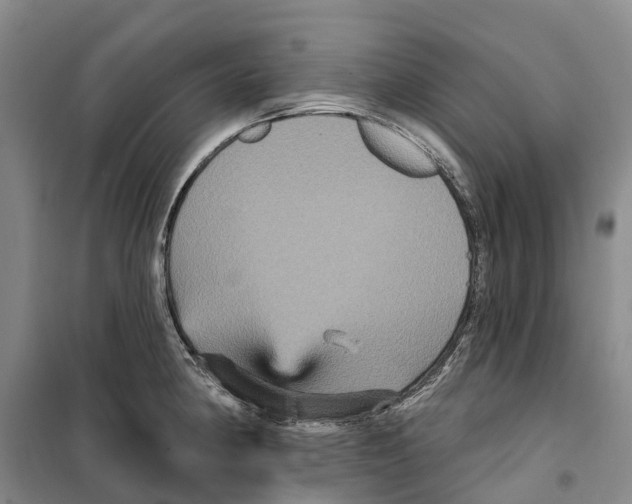 X0000099381190200806051114