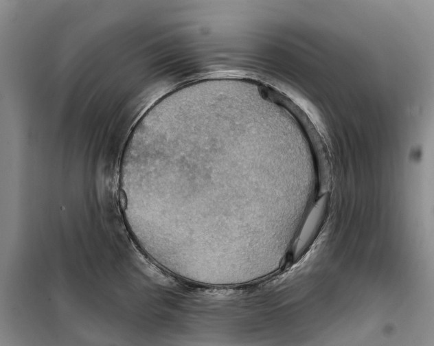 X0000099381193200806051114