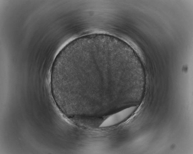 X0000099381198200806051113