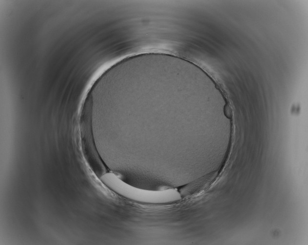 X0000099381200200806051113