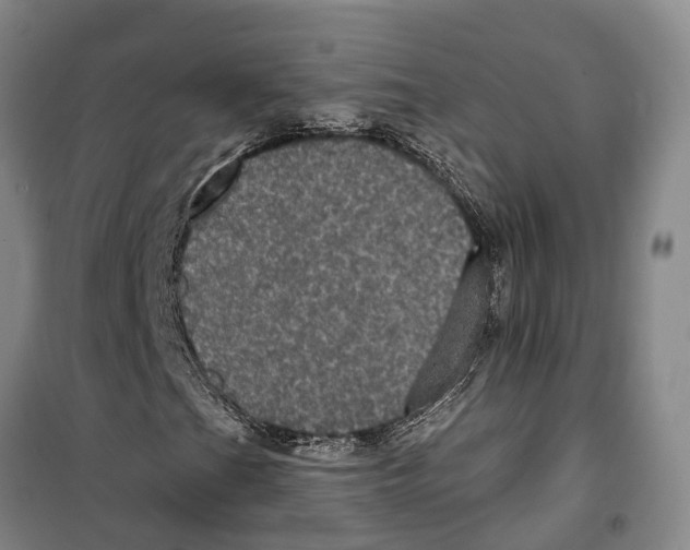 X0000099381201200806051113