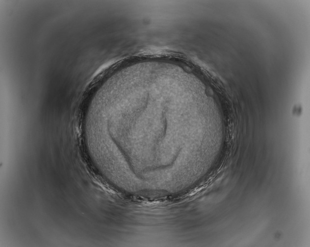 X0000099381206200806051113