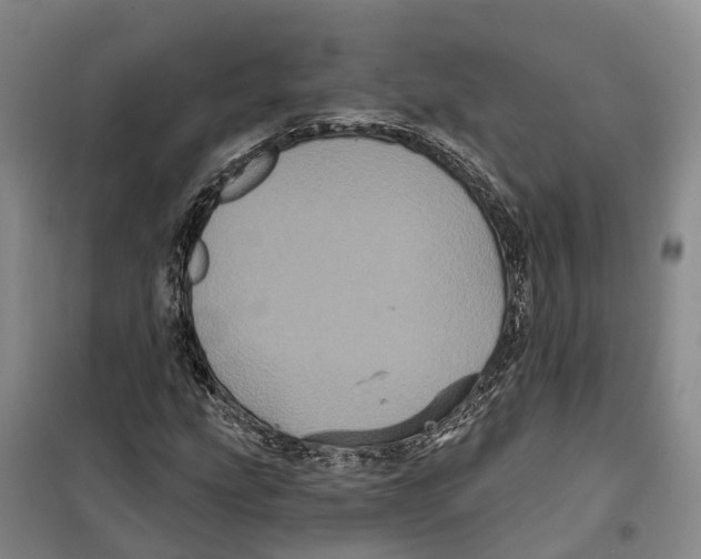 X0000099381207200806051113
