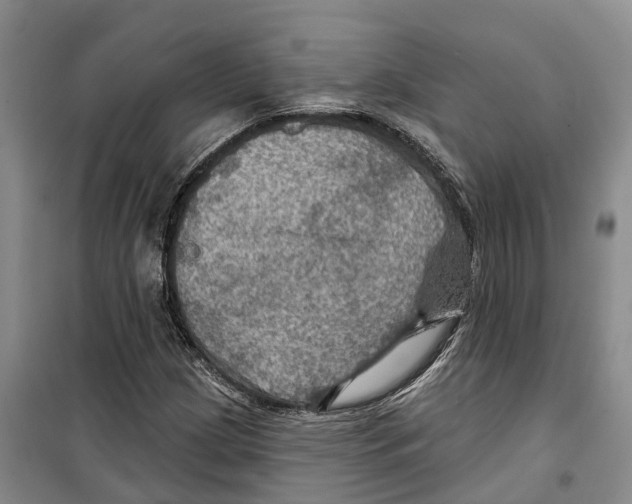 X0000099381209200806051113