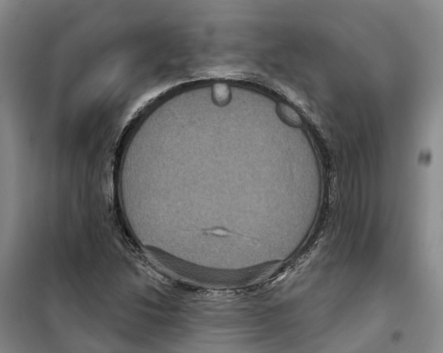 X0000099381214200806051113