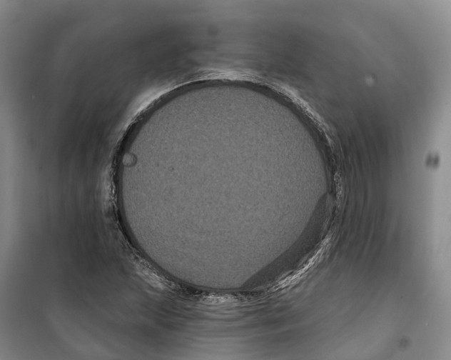 X0000099381215200806051113