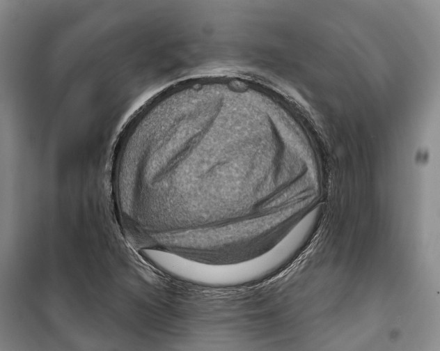 X0000099381216200806051113