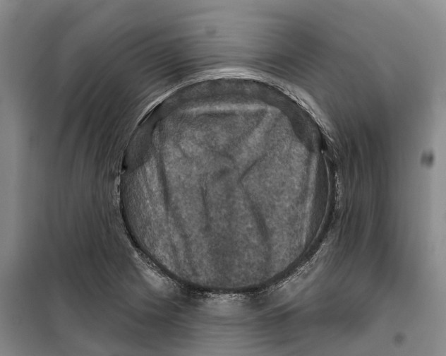 X0000099381225200806051113