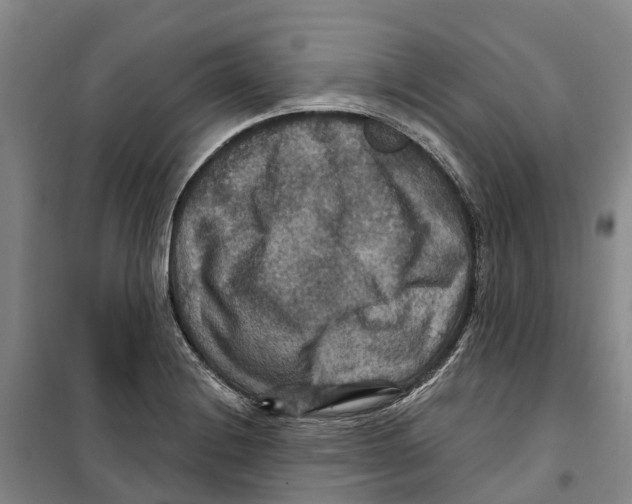 X0000099381228200806051113