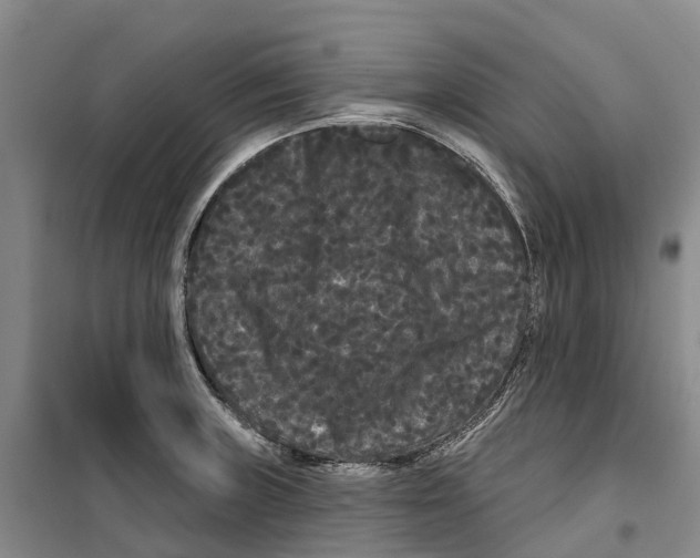 X0000099381235200806051113