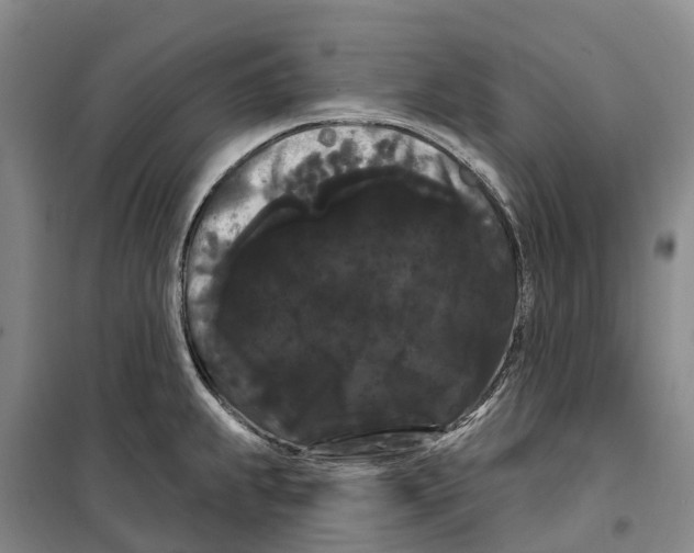 X0000099381239200806051113