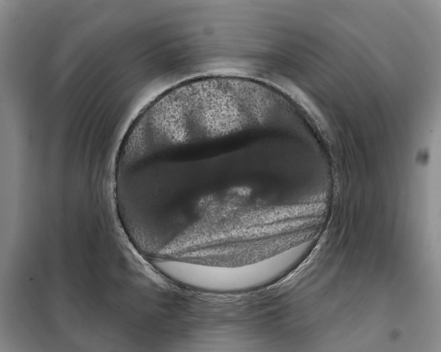 X0000099381240200806051113