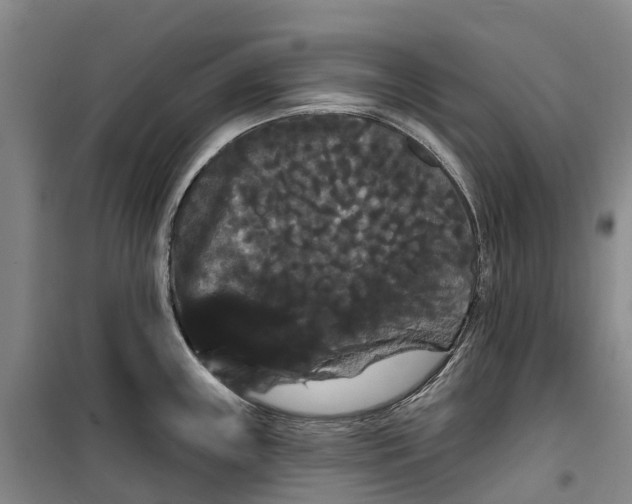 X0000099381243200806051113