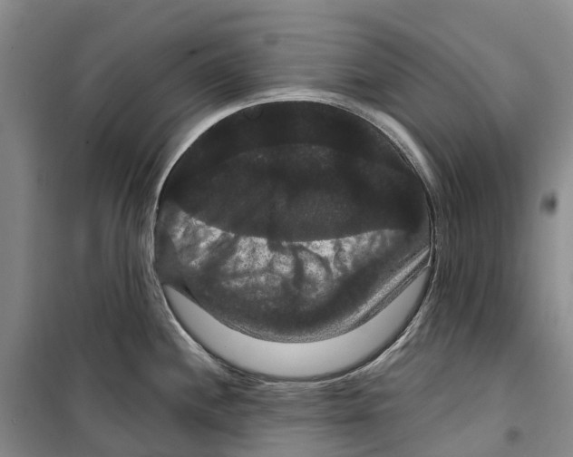 X0000099381244200806051113