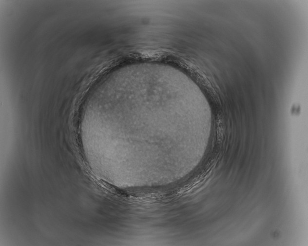 X0000099381249200806051113