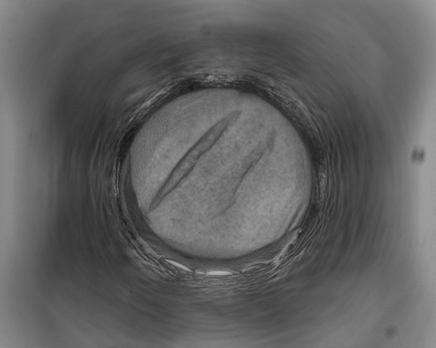 X0000099381250200806051113