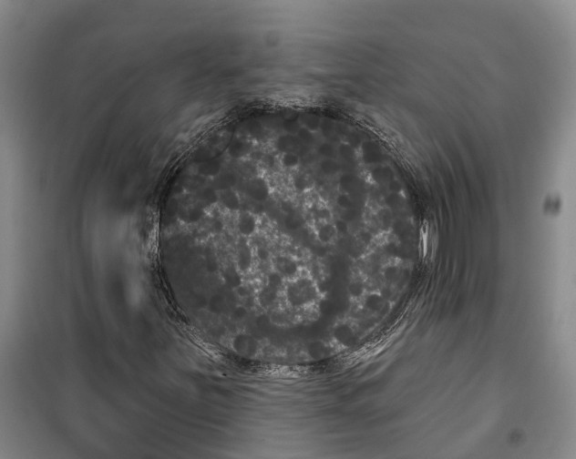 X0000099381251200806051113
