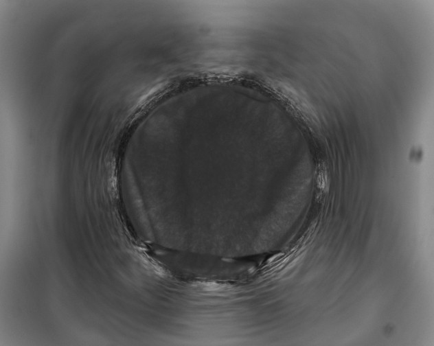 X0000099381252200806051113