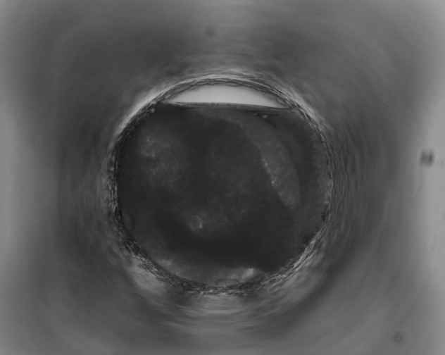 X0000099381256200806051113