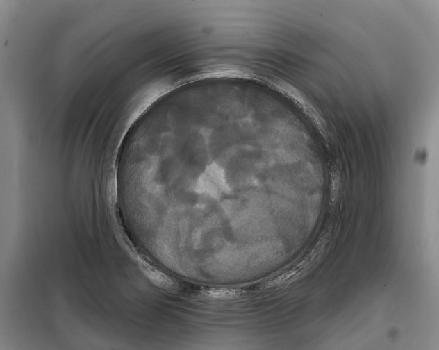 X0000099381274200806051112
