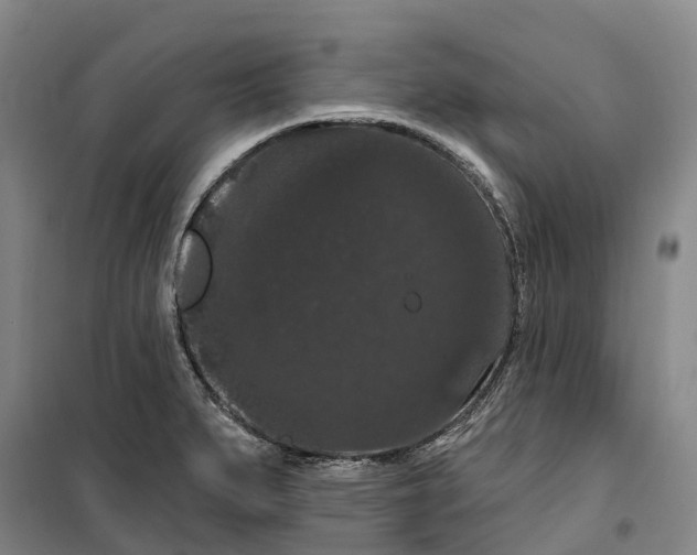 X0000099381279200806051112