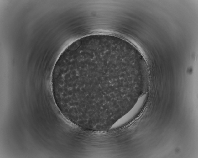 X0000099381283200806051112