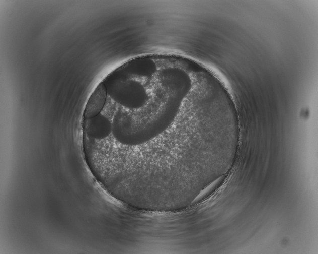 X0000099381287200806051112