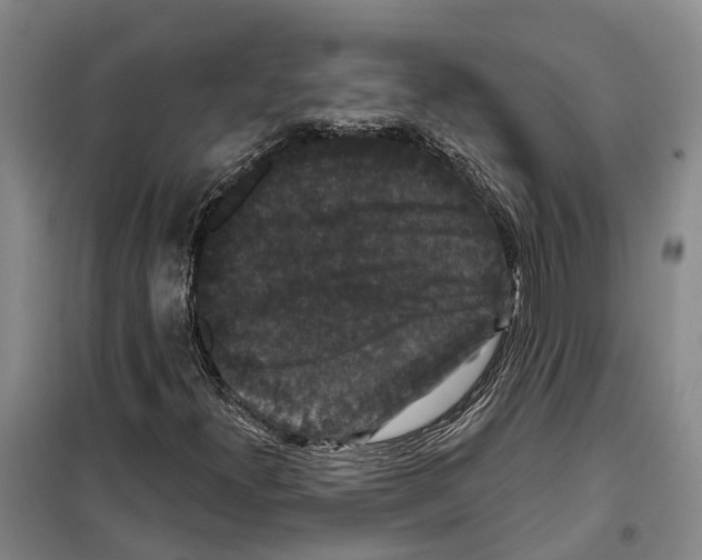X0000099381300200806051111