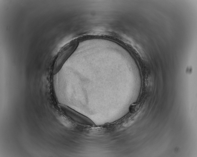 X0000099381304200806051111