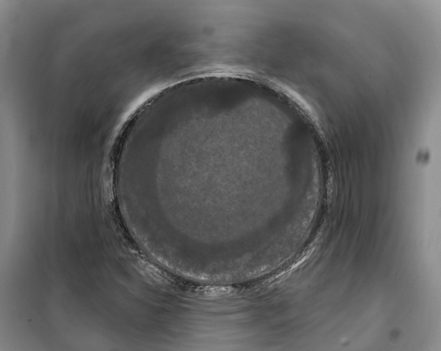 X0000099381310200806051112