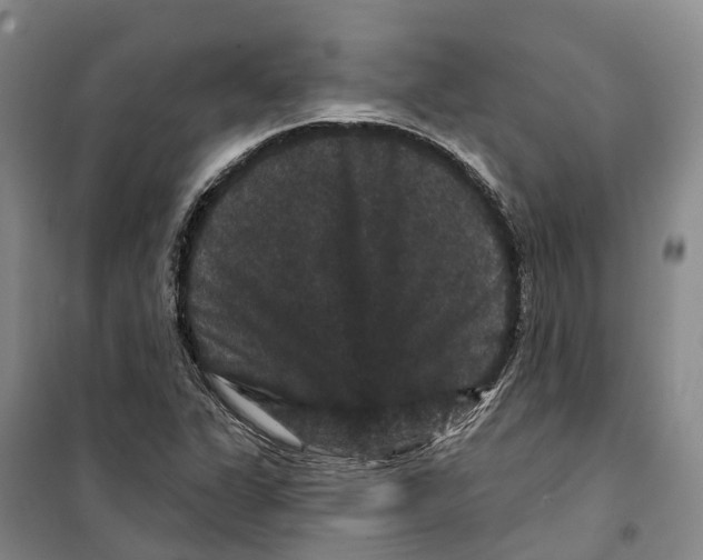 X0000099381311200806051112