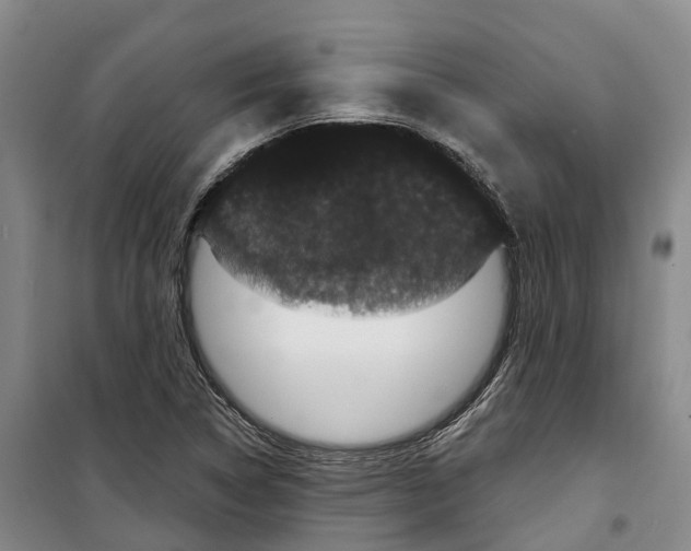 X0000099381314200806051112